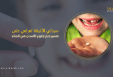 وقوع الاسنان في المنام