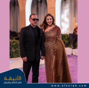 ظهور ورد الخال بطابع برنزي كلاسيكي